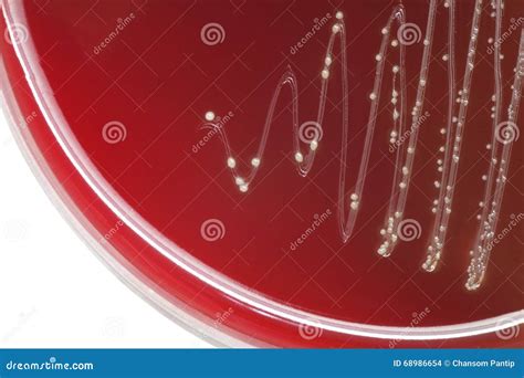 Streptococcus Bacterial Colonies With Alpha Hemolytic On Blood A Stock