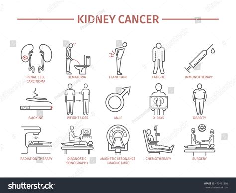 562 Malignant Kidney Cancer Images Stock Photos And Vectors Shutterstock