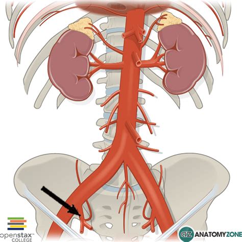 Right Internal Iliac Artery