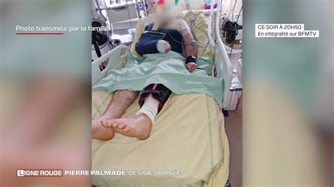 Accident De Pierre Palmade Des Photos Transmises Par La Famille Des