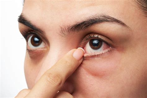 Is Diabetes Affecting Your Eyes 7 Signs Of Diabetic Eyes