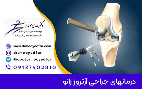 درمان جراحی آرتروز و ساییدگی مفصل زانو در بهترین کلینیک زانو اصفهان