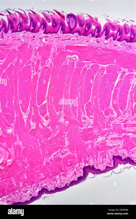 Filiform Papillae In A Tongue Longitudinal Section X25 At 10 Cm Wide