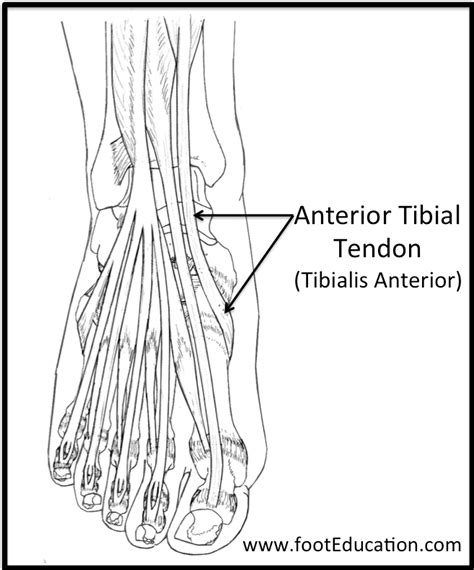 Anterior Tibial Tendonitis Footeducation