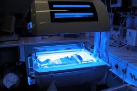 Phototherapy For The Treatment Of Jaundice  KidsHealth NZ