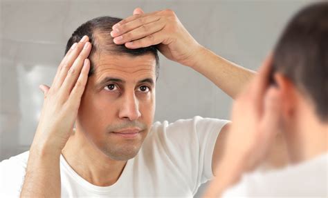 Prp For Hair Loss Dermatologists In Crest Hill And Naperville Premier