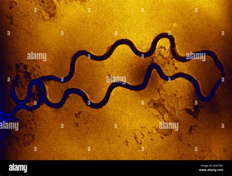 Treponema Pallidum Bacteria Fotografías E Imágenes De Alta Resolución