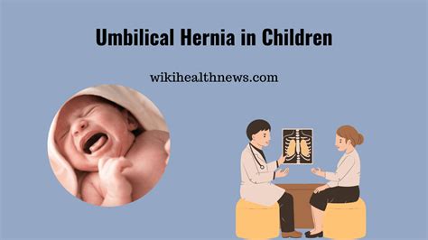 Causes Of Umbilical Hernia In Children Wiki Health News
