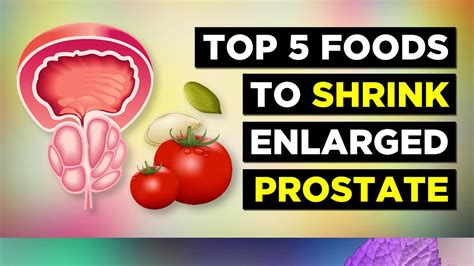 Top 5 Foods To Shrink Enlarged Prostate Youtube