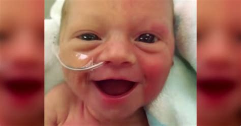 The Smile Of This Struggling Premature Baby Is Going Viral And Heres Why