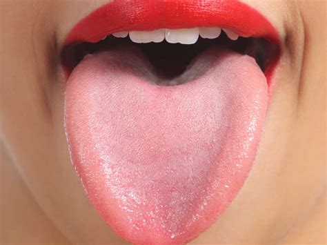 Buzzfeed staff anyone else have this on the roof of their mouth!?!?!? Red spots on roof of mouth: Causes and other symptoms