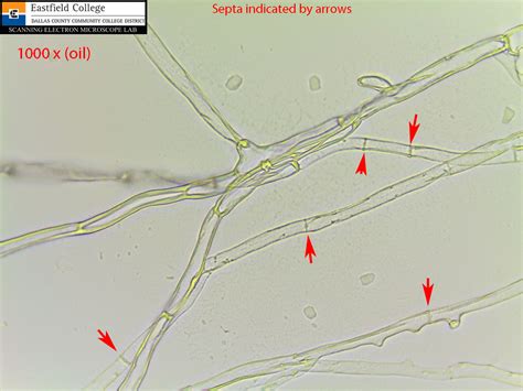 Scanning Electron Microscope Blog April 2013