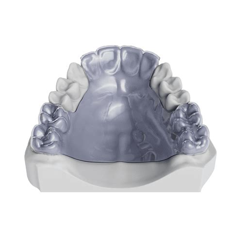 Theroux Phase 1 Retainer Odl Orthodontic Labs