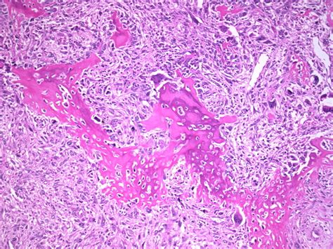 That suggests this terminology applies to. Webpathology.com: A Collection of Surgical Pathology Images