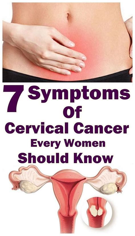 When the cervix swells it can lead to an obstructed blood flow, which eventually causes the leg to swell and gives a sore, painful sensation. Pin on Health