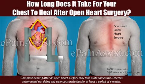 See full list on chicme.com Pin on Chest pain