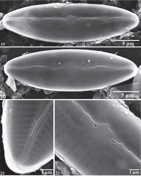 Nupela Major Sp Nov External View Of Raphe Valve Sem 19 And 20 The