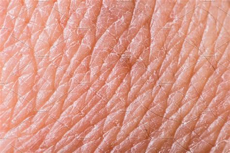 Texture Of Human Skin Stock Photo Containing Skin And Human High