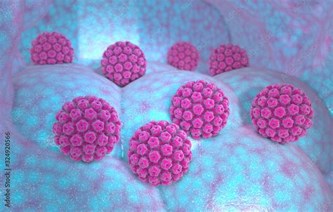 Human Papillomavirus Infection Virus Hpv Is The Most Common Sexually