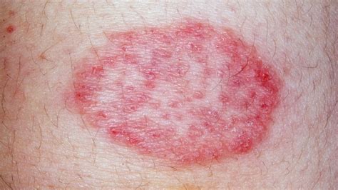 Skin Conditions Symptoms Treatments Diagnosis Health
