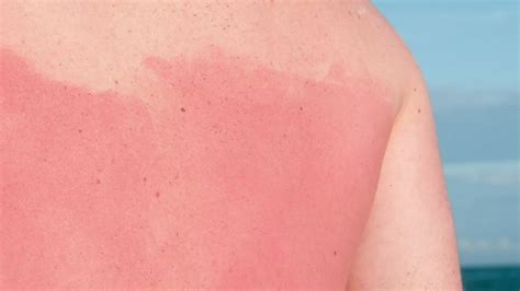 Consumer Reports Finds That Some Sunscreens Dont Live Up To Claims