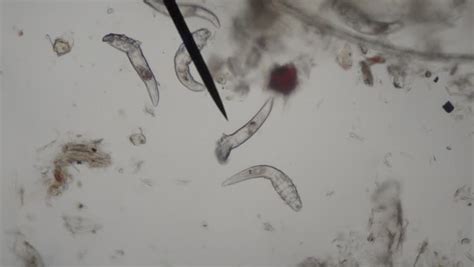 Demodectic Mange Demodex Demodex Canis Seen Under Microscope At 80
