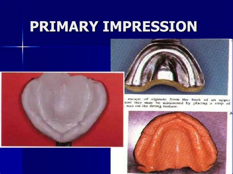 Ppt Complete Dentures Powerpoint Presentation Free Download Id4396236