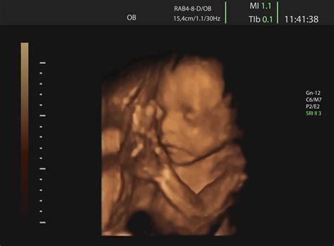 Gallery Baby Moments 3d 4d Ultrasound Scan Centre Oxfordshire