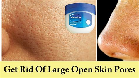 How To Get Rid Of Large Open Pores Permanently Large Open Pores On