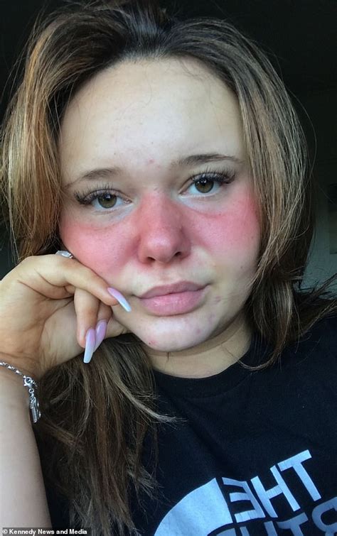 Lupus Suffering Teenager Shares Gruelling 90 Minute Makeup Routine To