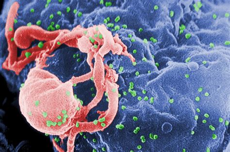 فيروس نقص المناعة البشرية يُقاوم الأدوية عبر تعديله لهياكله البروتينية