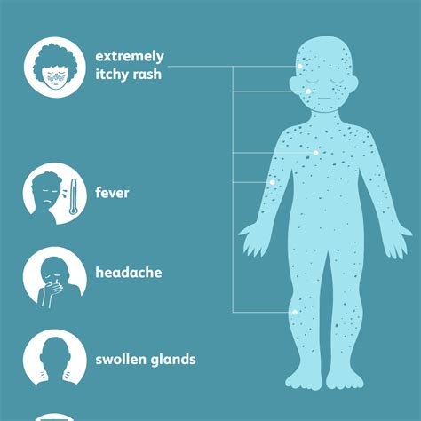 Chickenpox Signs Symptoms And Complications