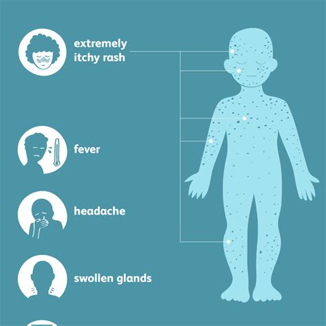 Bubbles On Hands Rash Dyshidrosis Symptoms And Causes