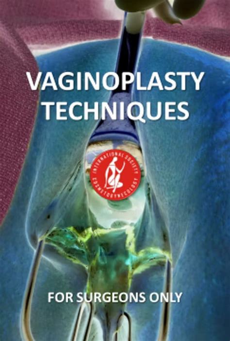 Iscg Vaginoplasty Techniques For Surgeons Medustudy