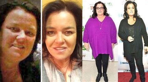 You need to focus on strength training more. Weight Loss 4 Months After Gastric Sleeve - postsindiano9 ...