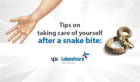 Tips On Taking Care Of Yourself After A Snake Bite Vps Lakeshore