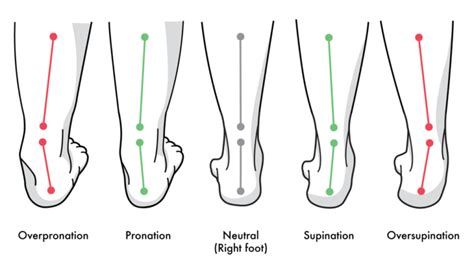 Supination Pronation Tend A Foot Orthotics