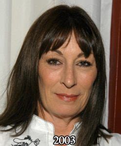 Anjelica Huston Plastic Surgery Before And After Photos Awful