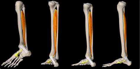 Posterior Tibialis Tendon Dysfunction Peak Physio