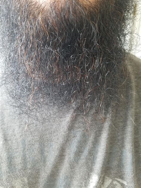I Naturally Have Black Hair But In My Beard There Are Lots Of Red