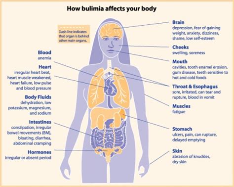 The Signs And Symptoms Of Eating Disorders