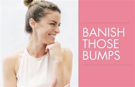 How To Get Rid Of Bumps On The Arms And Legs—once And For All