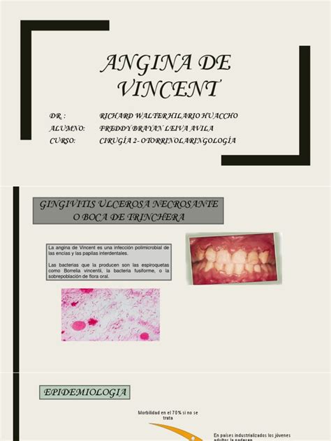 Angina De Vincent Pdf Microbiología Cuidado De La Salud