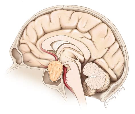 Pituitary Tumors General Information For Patients Patient Resource