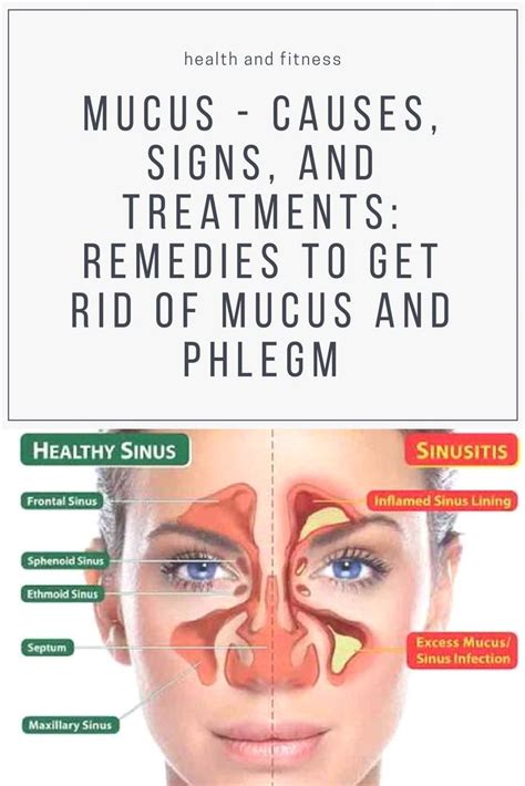 Mucus Causes Signs And Treatments Remedies To Get Rid Of Mucus And