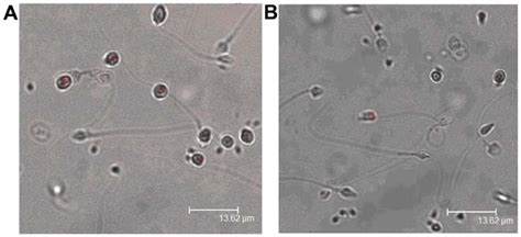 Immunofluorescent Staining Of Psmβ3 A Asthenozoospermia Group Psmβ3