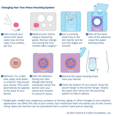 Types Of Pouching Systems L United Ostomy Association Of America