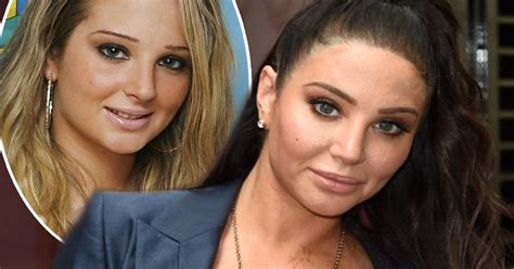 Tulisa Fires Back At Criticism Over Her Cosmetic Surgery ‘everyone
