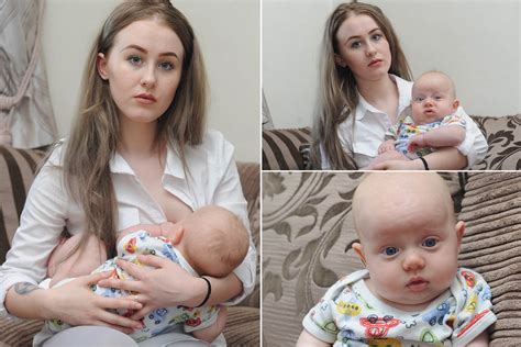 Young Mum Ordered To Stop ‘sexual Breastfeeding In Hospital