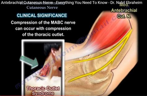 The Medial Antebrachial Cutaneous Nerve —